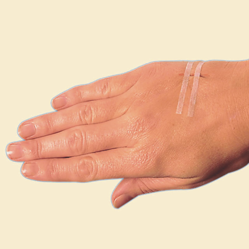 Λωρίδα κλεισίματος δέρματος