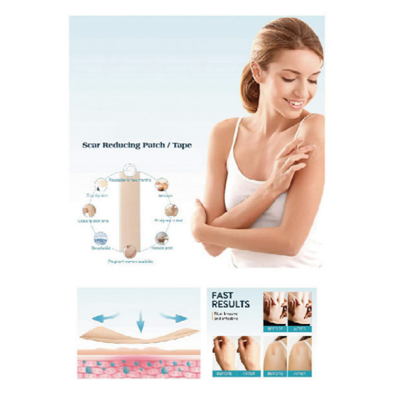 Επίδεσμος σιλικόνης